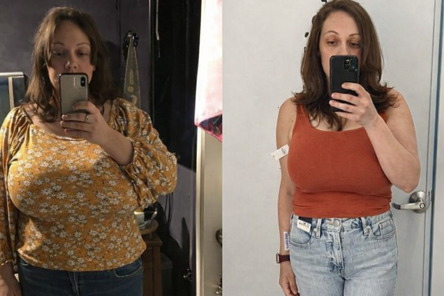 Transformation PUROTYN – Sophie M.